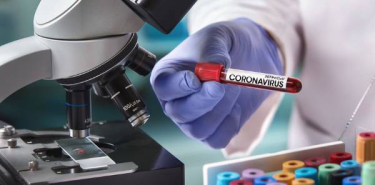 Türkiye'de bugün koronavirüsten 297 kişi hayatını kaybetti