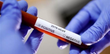 24 aile hekimi ile hemşirenin koronavirüs testi pozitif
