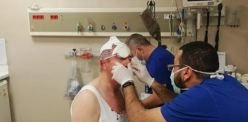 Selçuk Özdağ’a saldırıyla ilgili 4 şüpheli daha gözaltına alındı