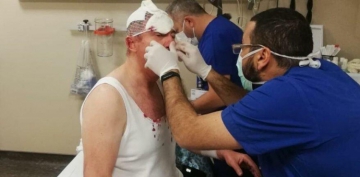 Özdağ’a saldıranlar hakkında hapis istemi