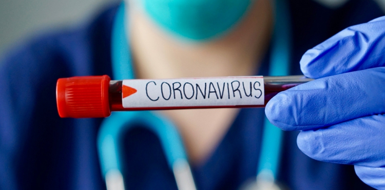 Koronavirüs nedeniyle bugün 120 kişi hayatını kaybetti